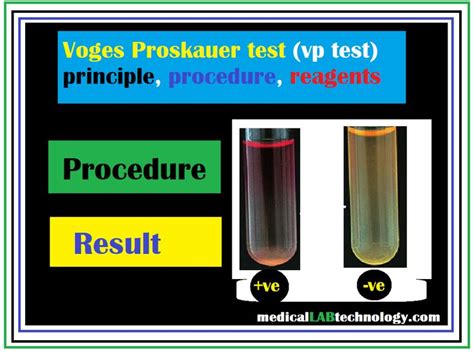 Voges Proskauer Test: Use, Principle, Procedure And Result .